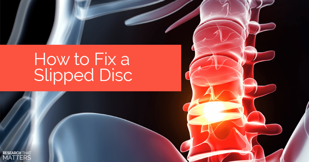 What is a Herniated Disc? The Science Behind Herniated Disc