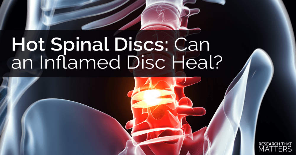 Disc Injury and the Role of Inflammation